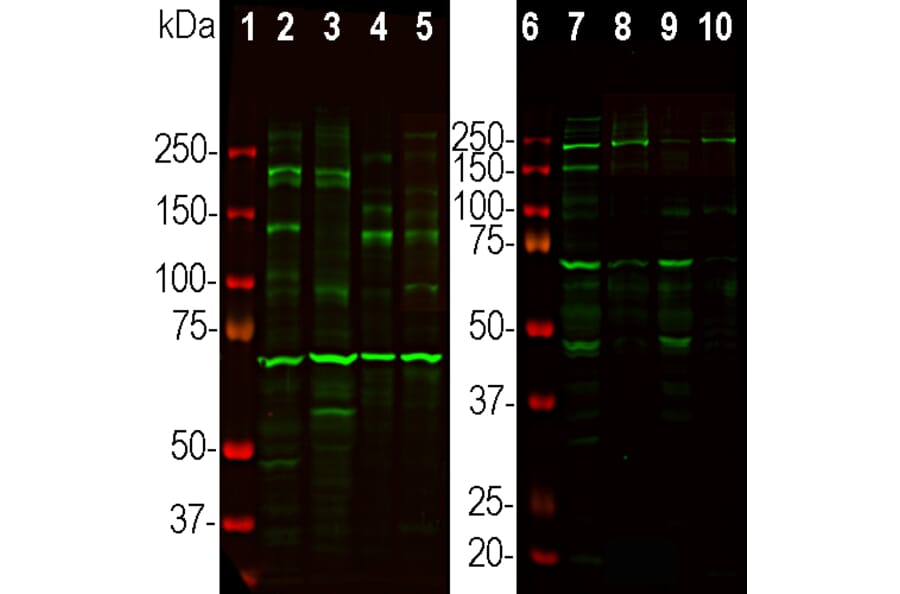 Western Blot - Anti-Ankyrin 3 Antibody (A104313) - Antibodies.com