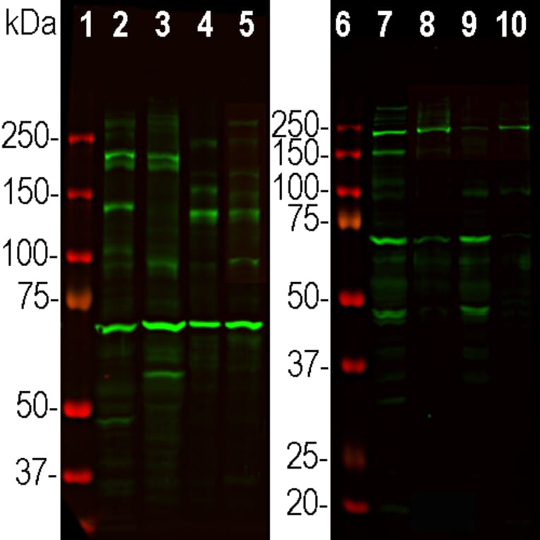 Western Blot - Anti-Ankyrin 3 Antibody (A104313) - Antibodies.com