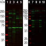 Western Blot - Anti-Ankyrin 3 Antibody (A104313) - Antibodies.com
