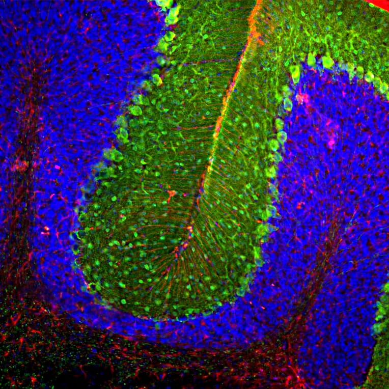 Immunofluorescence - Anti-GFAP Antibody - Antibodies.com (A104314)