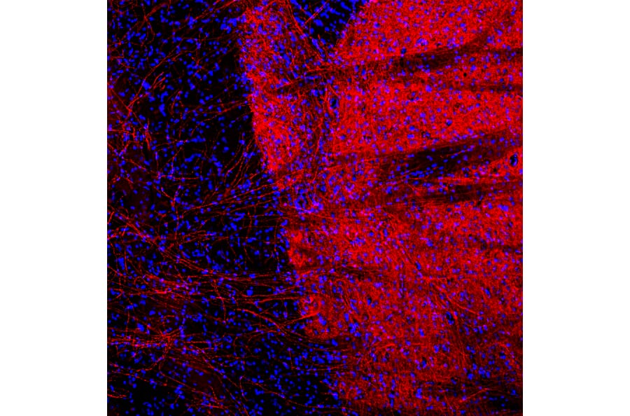 Immunofluorescence - Anti-Tyrosine Hydroxylase Antibody [4H2] (A104315) - Antibodies.com