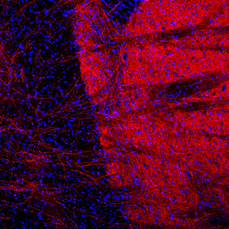 Immunofluorescence - Anti-Tyrosine Hydroxylase Antibody - Antibodies.com (A104315)