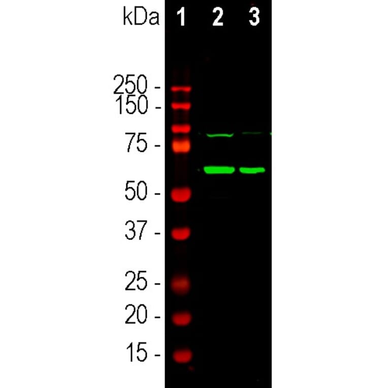 Western Blot - Anti-Tyrosine Hydroxylase Antibody - Antibodies.com (A104315)