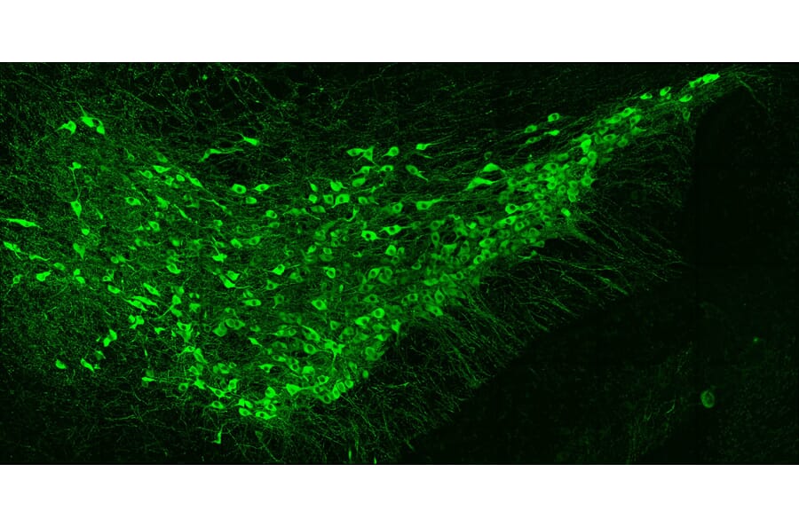 IHC - Anti-Tyrosine Hydroxylase Antibody [4H2] (A104315)
