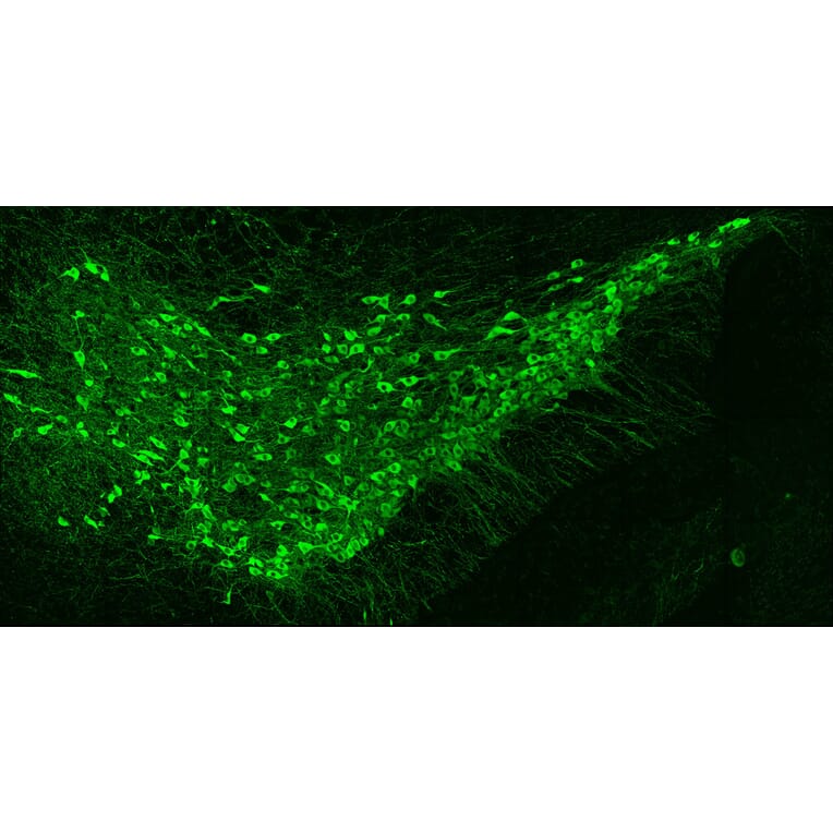 Immunofluorescence - Anti-Tyrosine Hydroxylase Antibody [4H2] (A104315) - Antibodies.com