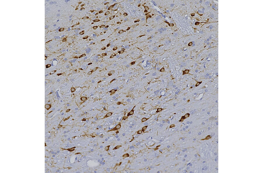 Immunohistochemistry - Anti-Tyrosine Hydroxylase Antibody [4H2] (A104315) - Antibodies.com