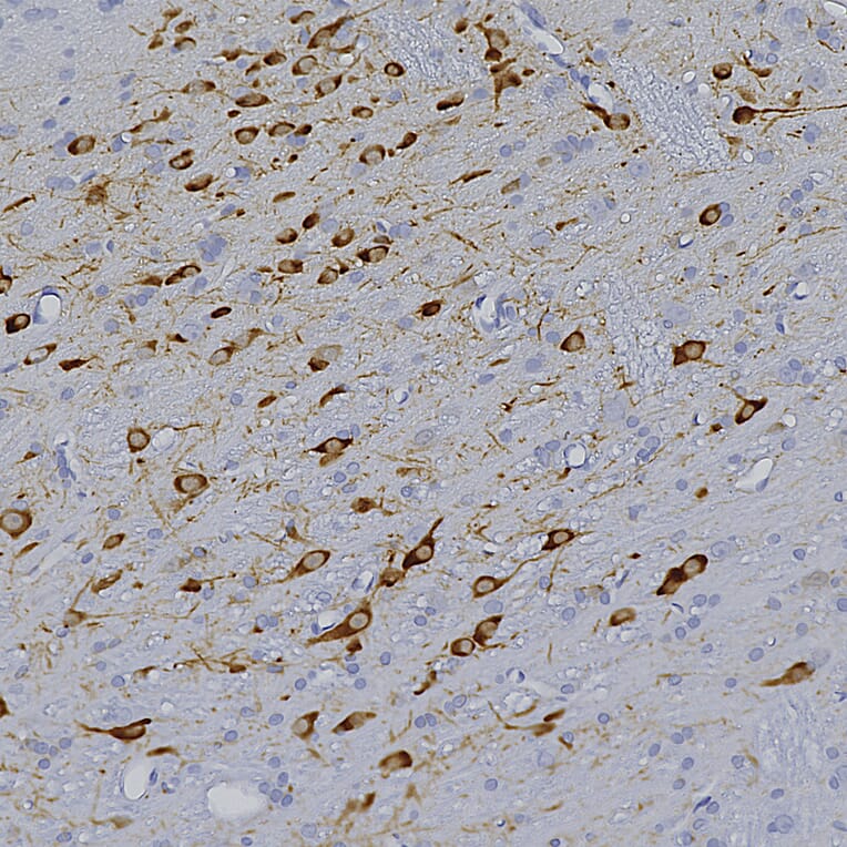 Immunohistochemistry - Anti-Tyrosine Hydroxylase Antibody [4H2] (A104315) - Antibodies.com