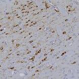 Immunohistochemistry - Anti-Tyrosine Hydroxylase Antibody [4H2] (A104315) - Antibodies.com