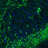 Immunofluorescence - Anti-Tyrosine Hydroxylase Antibody - Antibodies.com (A104316)