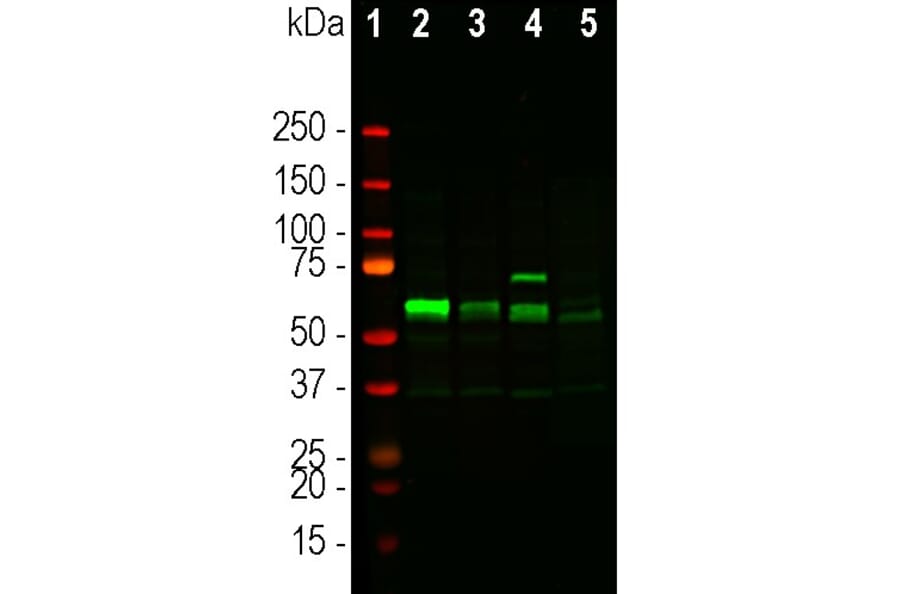 Western Blot - Anti-Tyrosine Hydroxylase Antibody (A104316) - Antibodies.com