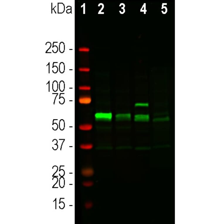 Western Blot - Anti-Tyrosine Hydroxylase Antibody - Antibodies.com (A104316)