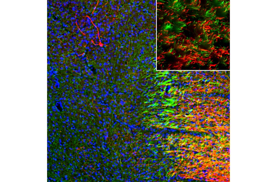 Immunofluorescence - Anti-Tyrosine Hydroxylase Antibody (A104316) - Antibodies.com