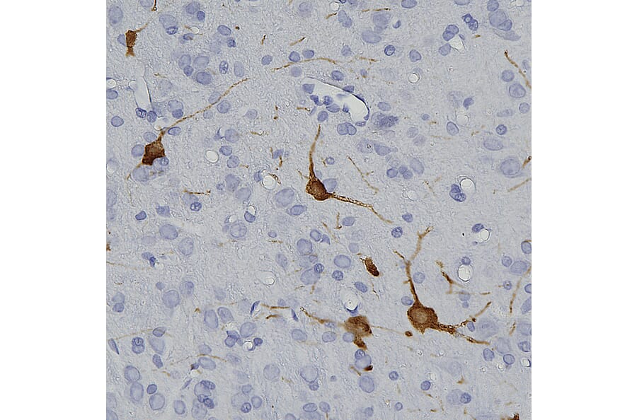 Immunohistochemistry - Anti-Tyrosine Hydroxylase Antibody (A104316) - Antibodies.com