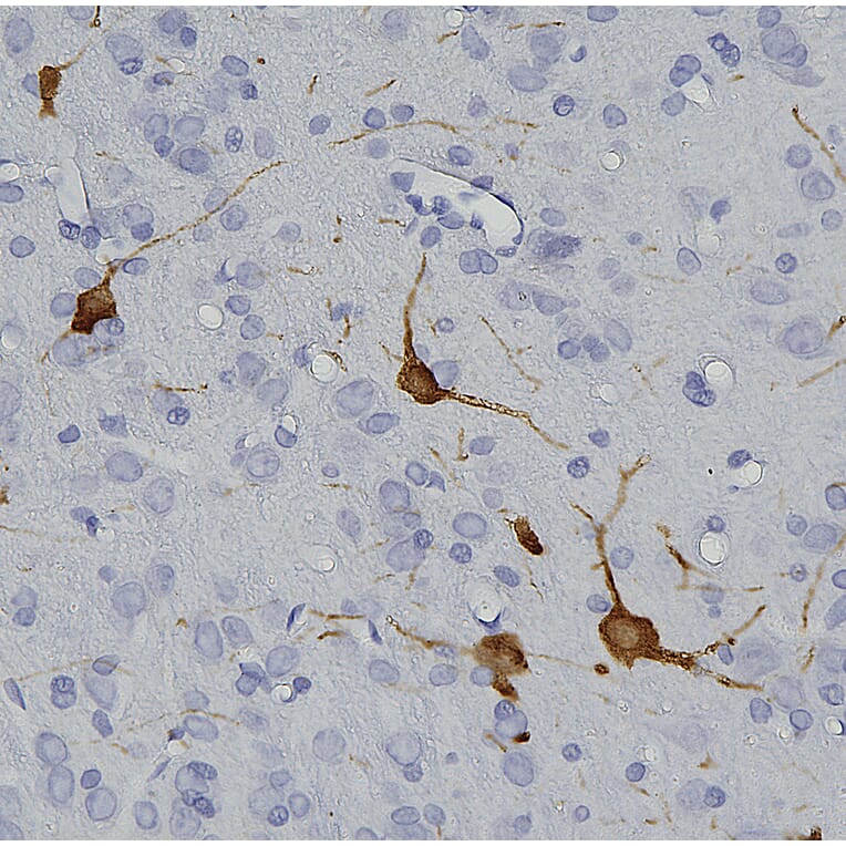 Immunohistochemistry - Anti-Tyrosine Hydroxylase Antibody (A104316) - Antibodies.com