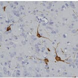 Immunohistochemistry - Anti-Tyrosine Hydroxylase Antibody (A104316) - Antibodies.com