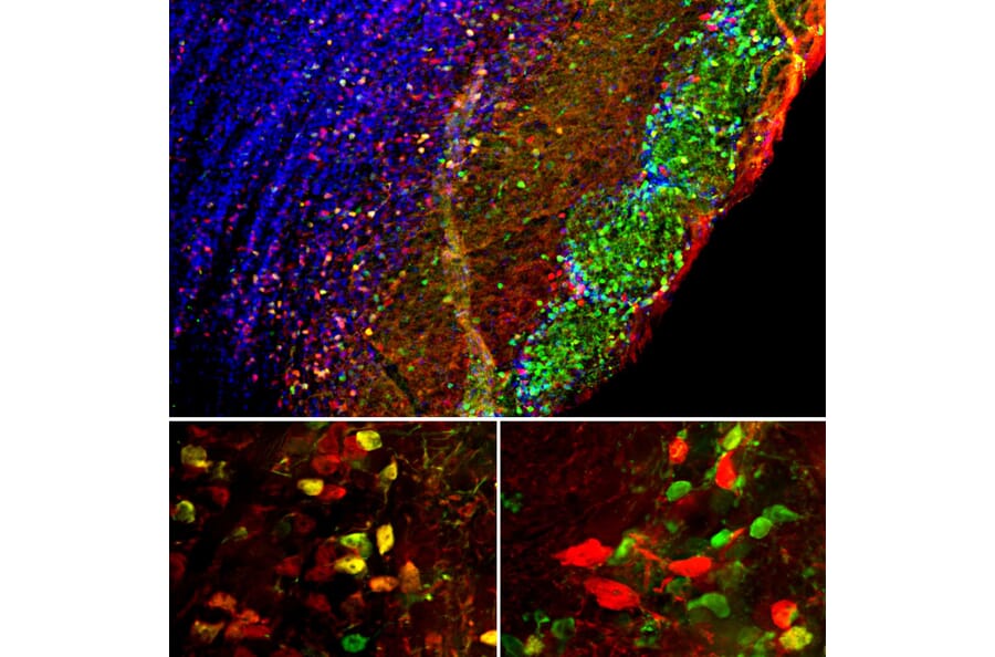 Immunofluorescence - Anti-Secretagogin Antibody (A104317) - Antibodies.com