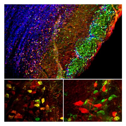 Immunofluorescence - Anti-Secretagogin Antibody - Antibodies.com (A104317)