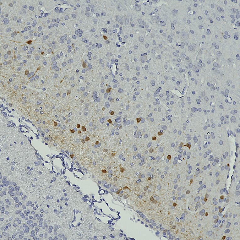 Immunohistochemistry - Anti-Secretagogin Antibody (A104317) - Antibodies.com