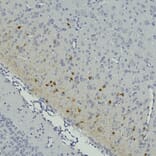 Immunohistochemistry - Anti-Secretagogin Antibody (A104317) - Antibodies.com