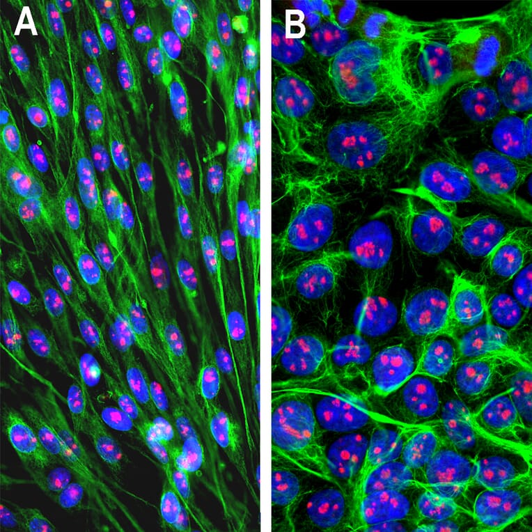 Immunofluorescence - Anti-Fibrillarin Antibody - Antibodies.com (A104318)