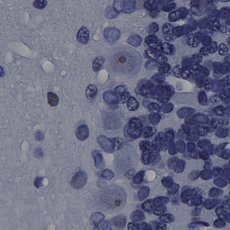 Immunohistochemistry - Anti-Fibrillarin Antibody [4A4] (A104318) - Antibodies.com