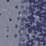 Immunohistochemistry - Anti-Fibrillarin Antibody [4A4] (A104318) - Antibodies.com