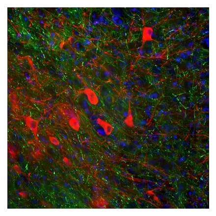 Immunofluorescence - Anti-Tyrosine Hydroxylase Antibody (A104319) - Antibodies.com