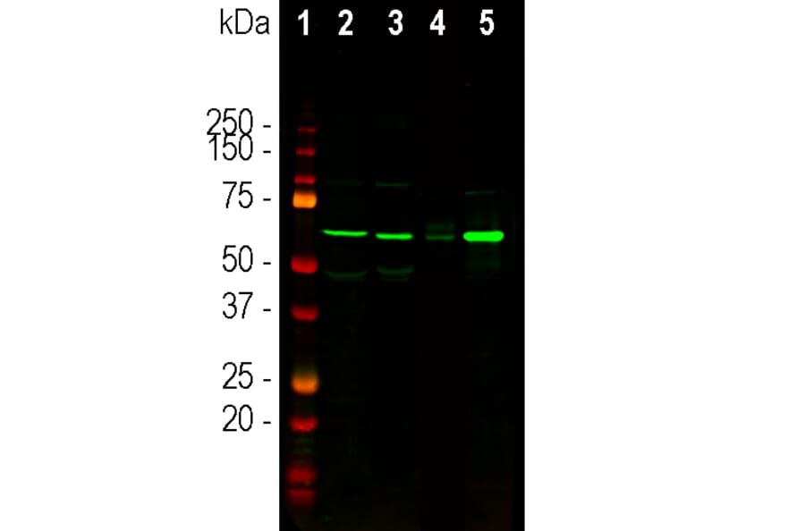 Western Blot - Anti-Tyrosine Hydroxylase Antibody (A104319) - Antibodies.com
