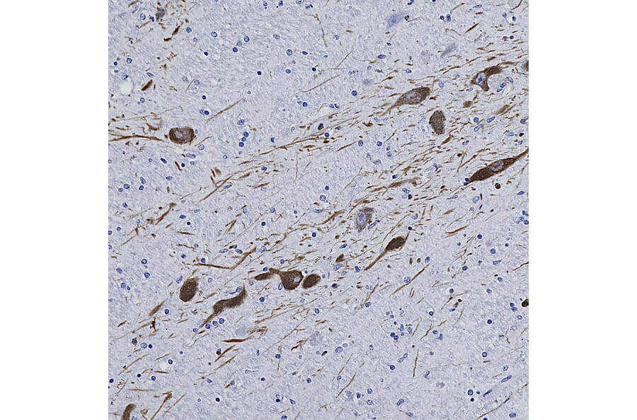 Immunohistochemistry - Anti-Tyrosine Hydroxylase Antibody (A104319) - Antibodies.com