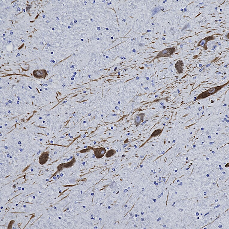Immunohistochemistry - Anti-Tyrosine Hydroxylase Antibody (A104319) - Antibodies.com
