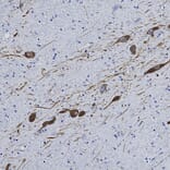 Immunohistochemistry - Anti-Tyrosine Hydroxylase Antibody (A104319) - Antibodies.com