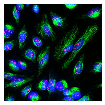 Immunofluorescence - Anti-Fibrillarin Antibody (A104320) - Antibodies.com