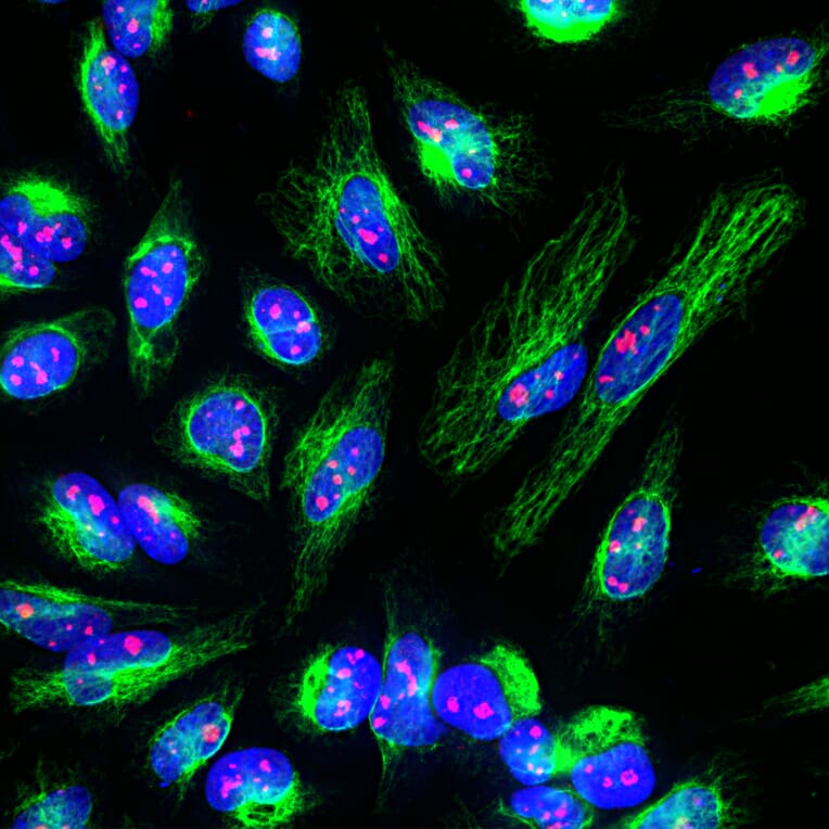 Immunofluorescence - Anti-Fibrillarin Antibody (A104320) - Antibodies.com