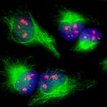 Immunofluorescence - Anti-Fibrillarin Antibody (A104320) - Antibodies.com