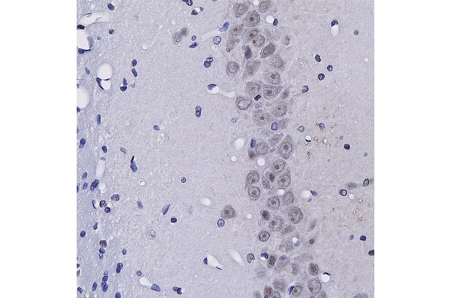 Immunohistochemistry - Anti-Fibrillarin Antibody (A104320) - Antibodies.com