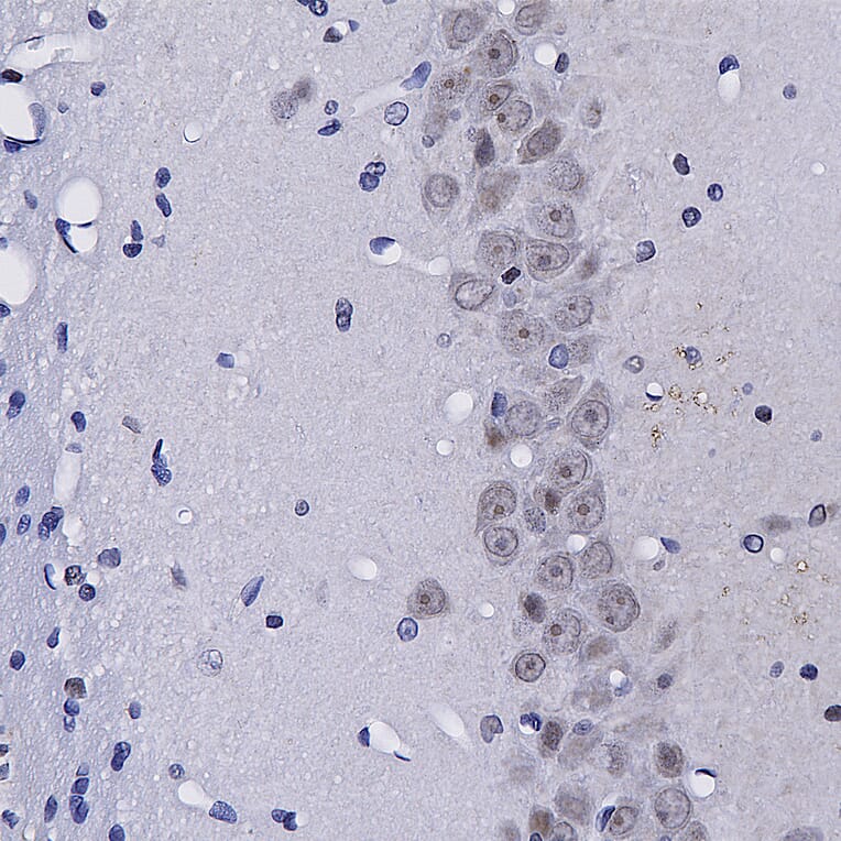 Immunohistochemistry - Anti-Fibrillarin Antibody (A104320) - Antibodies.com