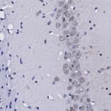 Immunohistochemistry - Anti-Fibrillarin Antibody (A104320) - Antibodies.com