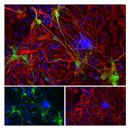 Immunofluorescence - Anti-Galectin 3 Antibody (A104321) - Antibodies.com