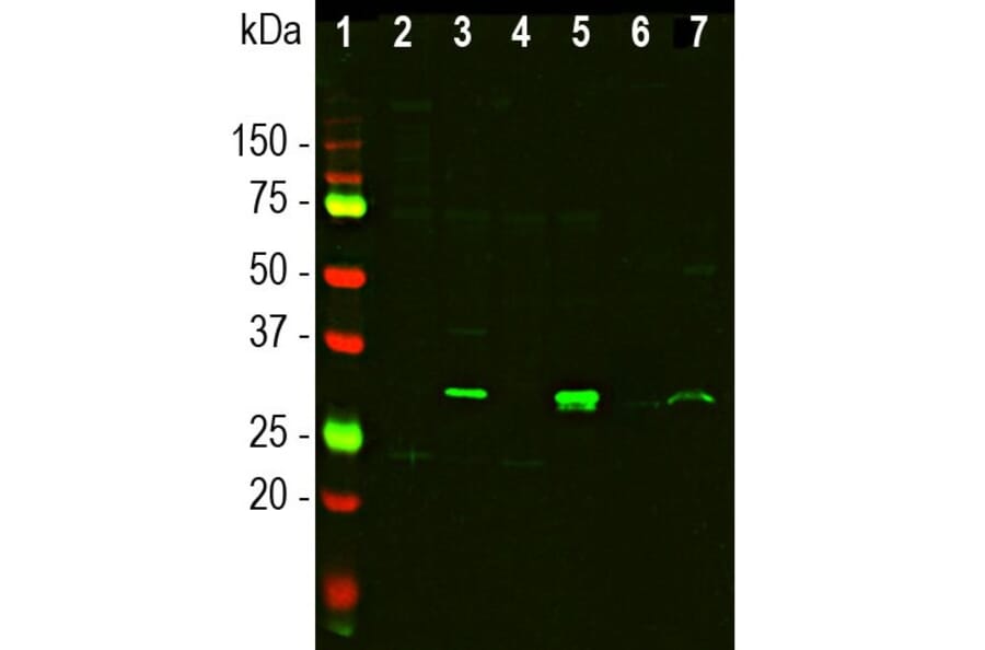 Western Blot - Anti-Galectin 3 Antibody (A104321) - Antibodies.com