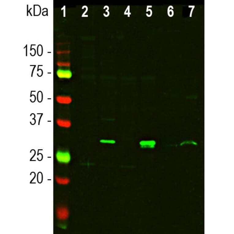 Western Blot - Anti-Galectin 3 Antibody (A104321) - Antibodies.com