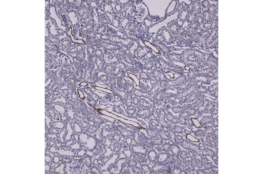 Immunohistochemistry - Anti-Galectin 3 Antibody (A104321) - Antibodies.com