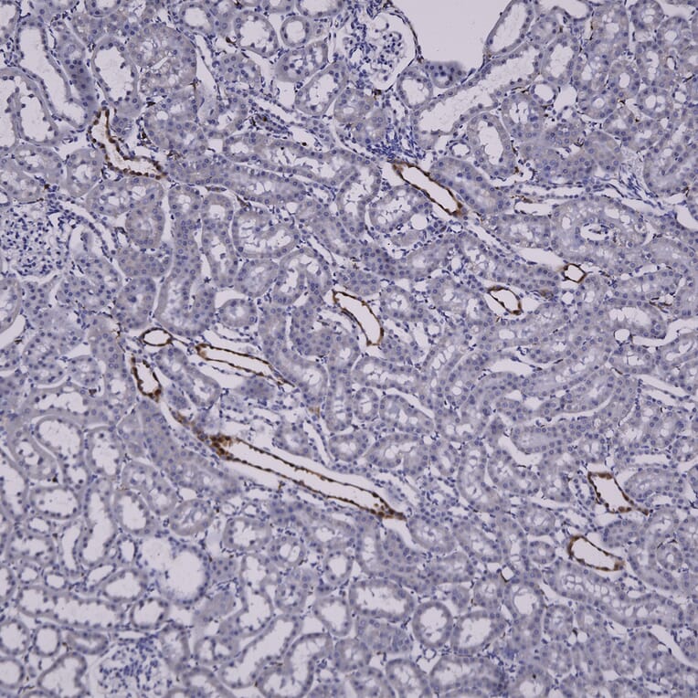 Immunohistochemistry - Anti-Galectin 3 Antibody (A104321) - Antibodies.com
