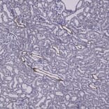 Immunohistochemistry - Anti-Galectin 3 Antibody (A104321) - Antibodies.com
