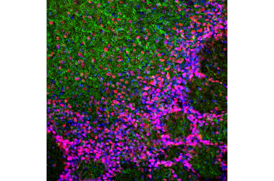 Immunofluorescence - Anti-MeCP2 Antibody (A104322) - Antibodies.com