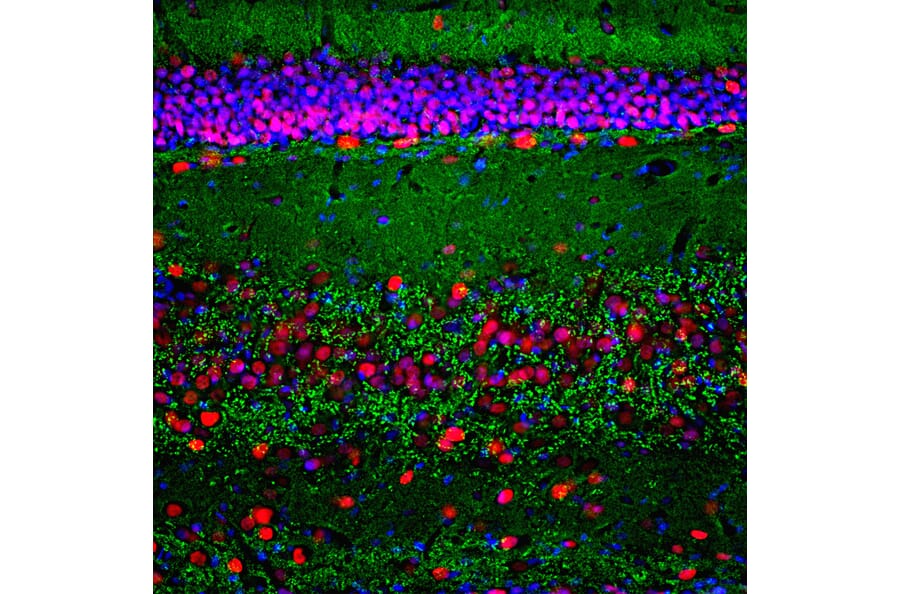 Immunofluorescence - Anti-MeCP2 Antibody (A104322) - Antibodies.com
