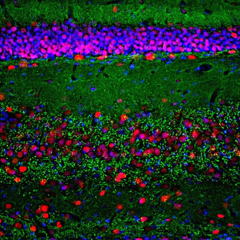 Immunofluorescence - Anti-MeCP2 Antibody (A104322) - Antibodies.com