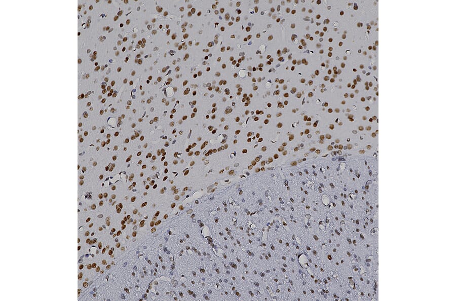 Immunohistochemistry - Anti-MeCP2 Antibody (A104322) - Antibodies.com