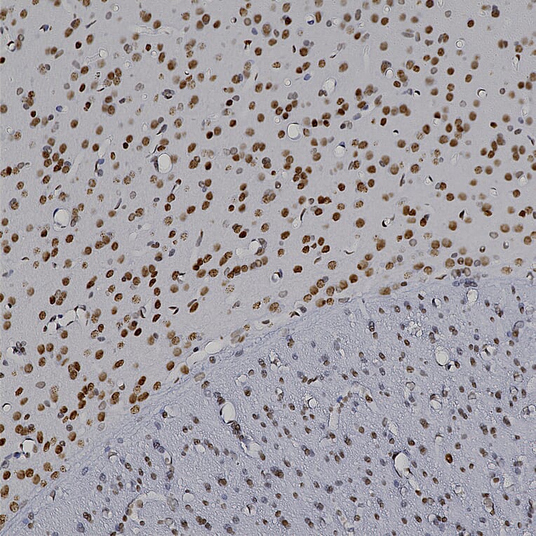 Immunohistochemistry - Anti-MeCP2 Antibody (A104322) - Antibodies.com