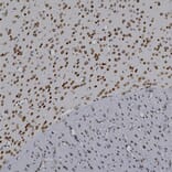 Immunohistochemistry - Anti-MeCP2 Antibody (A104322) - Antibodies.com