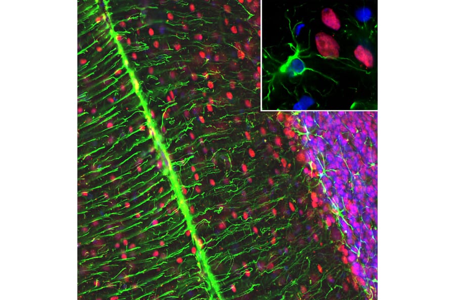 Immunofluorescence - Anti-MeCP2 Antibody [5H12] (A104323) - Antibodies.com